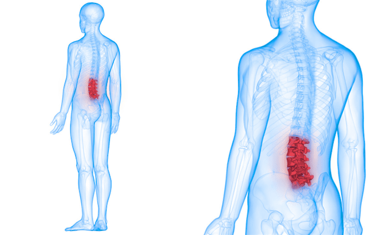 Ernia del disco colonna vertebrale trattamento osteopatico