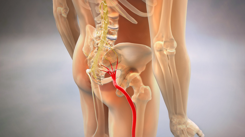 Dolore al nervo sciatico sciatalgia trattamento osteopatico